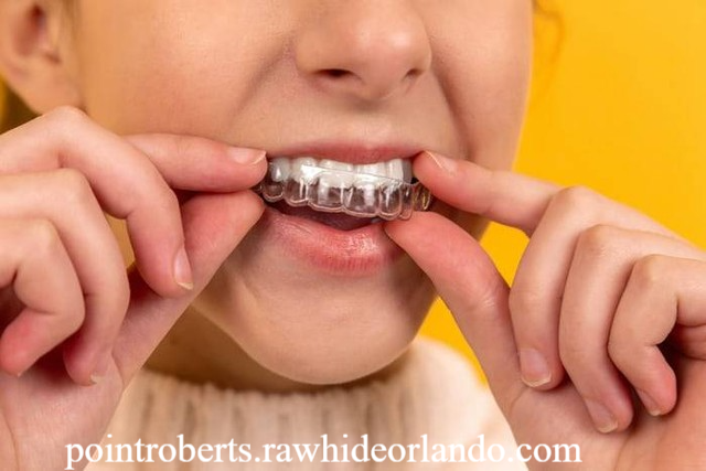 Panduan Lengkap Cara Memundurkan Gigi Tonggos