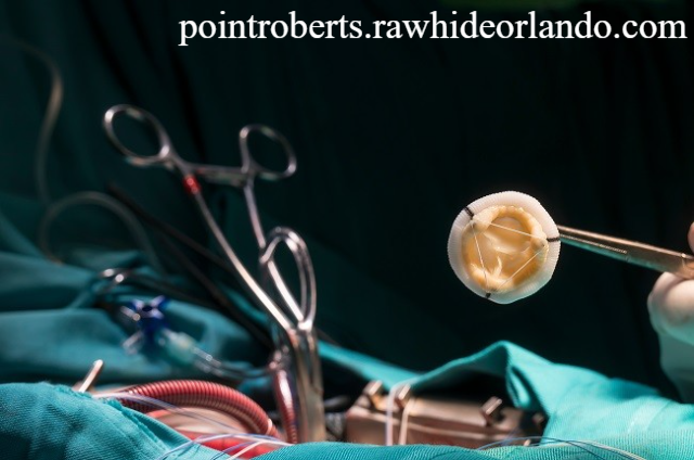 Panduan Lengkap Operasi Sinusitis Kondisi yang Memerlukannya dan Risiko yang Terlibat